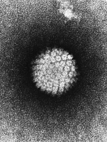 Electron microscope image of HPV